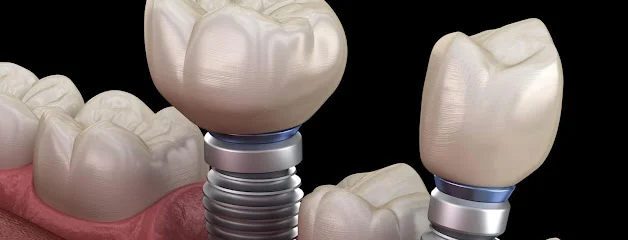 Expertos Dentista E Implantes